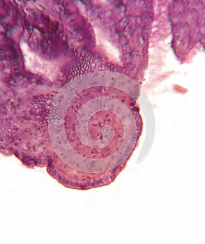 Gall bladder, microscopic