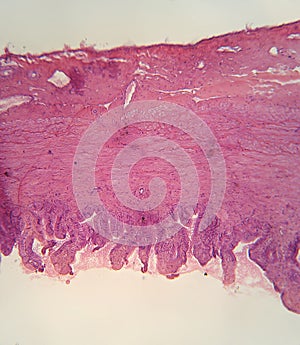 Gall bladder, microscopic cross section