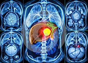 Gallbladder Scan Findings Potential Obstruction or Anatomical Anomaly photo