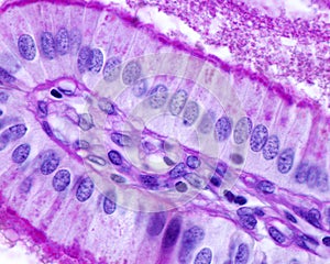 Gallbladder. Simple columnar epithelium photo