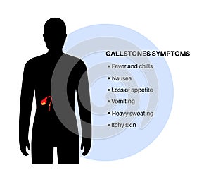 gallbladder stones symptoms