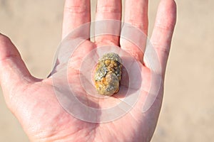 Gallstone in hand, Gall bladder stone. result of gallstones. Calculus of heterogeneous composition photo