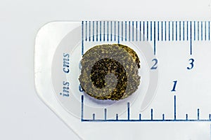 Gallstone removed with the Gallbladder. photo
