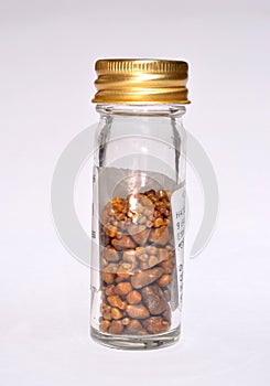 Gallstones in specimen jar