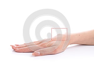 Ganglion cyst on woman hand circled in red square isolated on white background