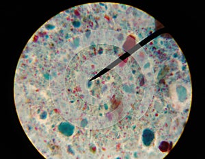 Gardia lamblia protozoa with trichrom stain.