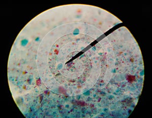 Gardia lamblia protozoa with trichrom stain in parasitology.