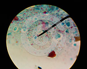 Gardia lamblia protozoa with trichrom stain in parasitology.