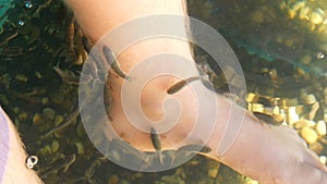 Garra Rufa fish foot care with natural peeling and massage. In the process, they secrete special enzymes that promote