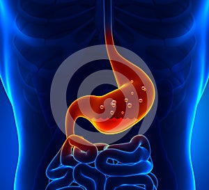 Gastric Acid