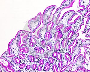 Gastric epithelium. PAS method