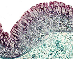 Gastric mucosa. Masson trichrome stain photo
