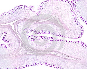 Gastric mucosa. PAS method