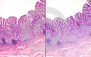 Gastric mucosa. Pyloric region photo