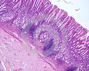 Gastric mucosa. Pyloric region