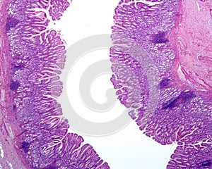 Gastric mucosa. Pyloric region photo