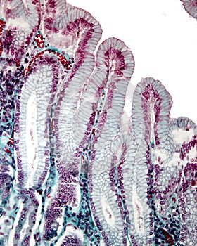 Gastric pits. Masson trichrome stain photo