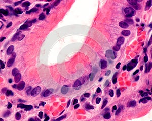 Gastric pit. Foveolar cells photo
