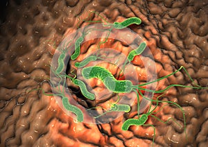 Gastritis, helicobacter pylori bacteria damaging mucus layer, medically accurate 3D illustration