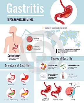 Gastritis symptoms stomach ulcer causes information on unhealthy food habits world population affected infographic poster vector