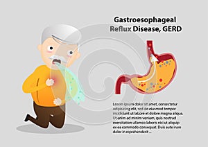 Gastro-Esophageal Reflux Disease GERD