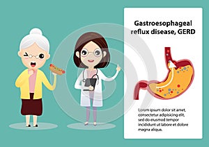 Gastro-Esophageal Reflux Disease GERD