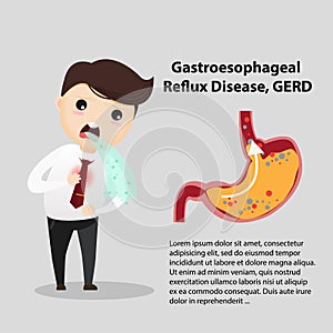 Gastro-Esophageal Reflux Disease GERD