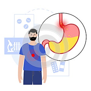 Gastroesophageal reflux disease