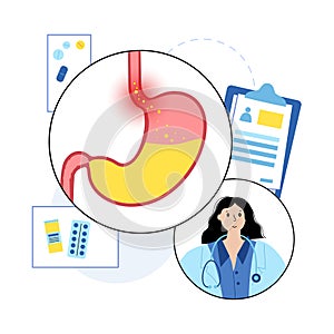 Gastroesophageal reflux disease