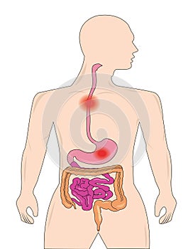 Gastrointestinal