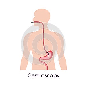 Gastroscopy Flat Concept