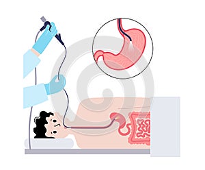 Gastroscopy endoscopy procedure