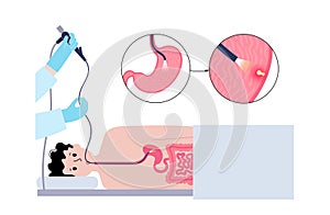 Gastroscopy endoscopy procedure