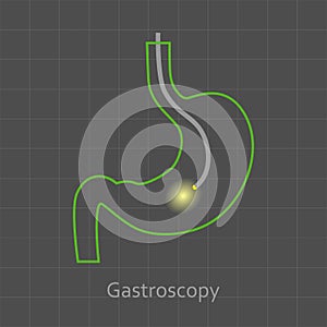 Gastroscopy Procedure Icon