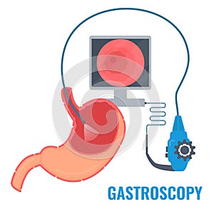 Gastroscopy procedure of stomach examination with endoscope