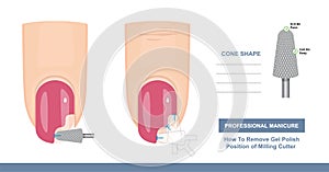 Gel Polish flake off. How to Remove it. Position of Cone Shape Milling Cutter. Top View. Tips and Tricks. Professional Manicure photo