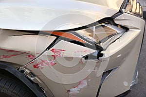 Dented car photo