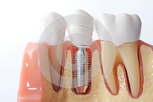 Zahnmedizinisch zähne 