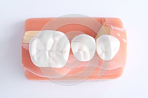 Generic dental teeth model