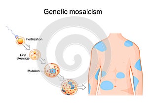 Genetic mosaicism. Somatic mutation photo