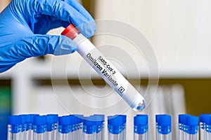 German word for Covid 19 Omicron Variant on test tube photo
