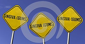 Gingiva (Gums) - three yellow signs with blue sky background