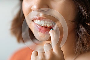 Gingivitis Concept. Young Woman Pulling Her Lip And Demonstrating Irritated Gums