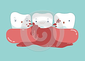 Gingivitis of dental and blood vector photo