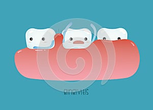 Gingivitis of dental vector photo