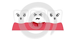 Gingivitis tooth / blood bleeding vector photo