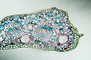 Ginko leaf in cross section