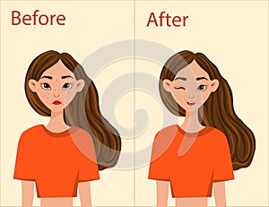 Girl before and after acne treatment. Cartoon style. Vector illustration.