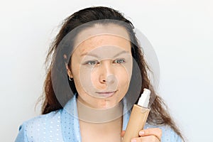 The girl applies a tonal corrective cream on a problematic pigmentation face.