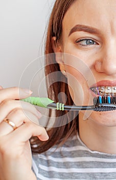 A girl with braces on her teeth smiles and holds a toothbrush